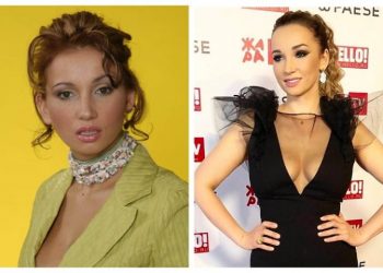 Звезды, которые решились на пластику и уколы красоты: 30 фото